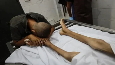 খেলাধুলায় ‘চ্যাম্পিয়ন’ ফিলিস্তিনি কিশোরের অনাহারে মৃত্যু