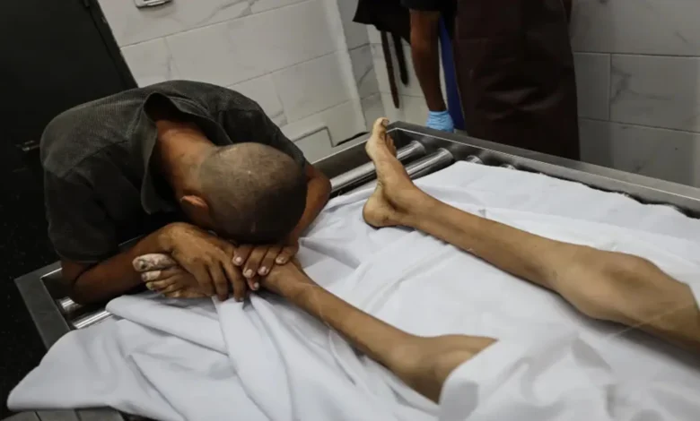 খেলাধুলায় ‘চ্যাম্পিয়ন’ ফিলিস্তিনি কিশোরের অনাহারে মৃত্যু