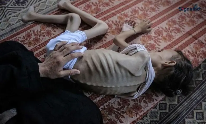 গাজায় ইসরায়েলি আগ্রাসনে নিহত ৬২ হাজার, ১৯ হাজার শিশু