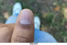 চাকসু নির্বাচনে ভোটের কালি মুছে যাওয়ায় বিতর্ক, অভিযোগ জানাবে ছাত্রদল
