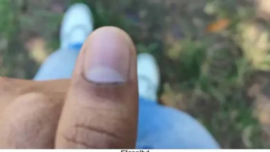 চাকসু নির্বাচনে ভোটের কালি মুছে যাওয়ায় বিতর্ক, অভিযোগ জানাবে ছাত্রদল