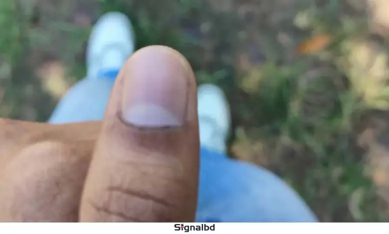 চাকসু নির্বাচনে ভোটের কালি মুছে যাওয়ায় বিতর্ক, অভিযোগ জানাবে ছাত্রদল