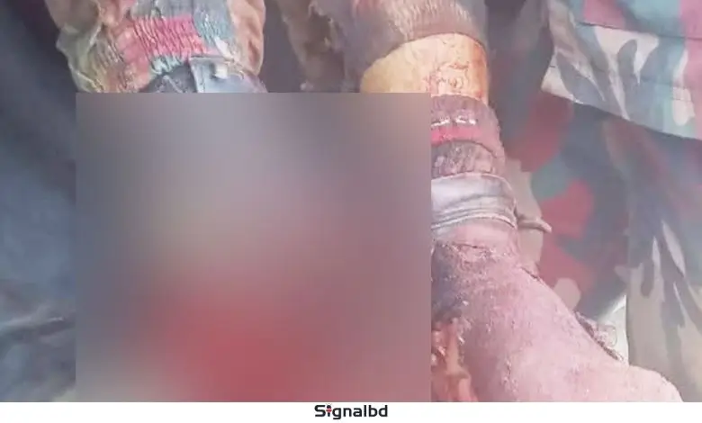 মিয়ানমার সীমান্তে স্থলমাইন বিস্ফোরণে উড়ে গেল বিজিবি সদস্যের পা