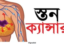 স্তন ক্যানসারের ঝুঁকি এড়াতে সচেতন জীবনযাপনই মূল পথ