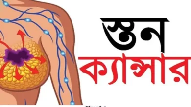 স্তন ক্যানসারের ঝুঁকি এড়াতে সচেতন জীবনযাপনই মূল পথ