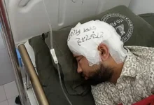 ফ্রিজে রাখা খুলি ২ মাস পর লাগানো হলো মামুনের মাথায়